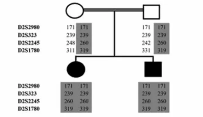 Figure 1. The scores of microsatellite marker analysis surrounding  the TPO locus depicted on the family pedigree
