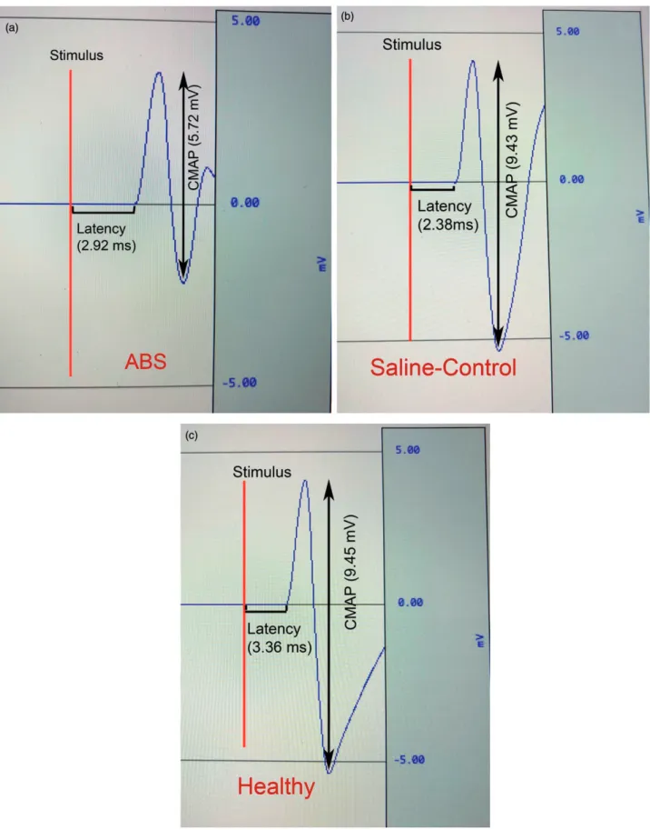Figure 6. ABS reduced CMAP, extended onset latency. Representative CMAP and latency responses from ABS leg (a), Saline leg (b) and Healthy leg (c).