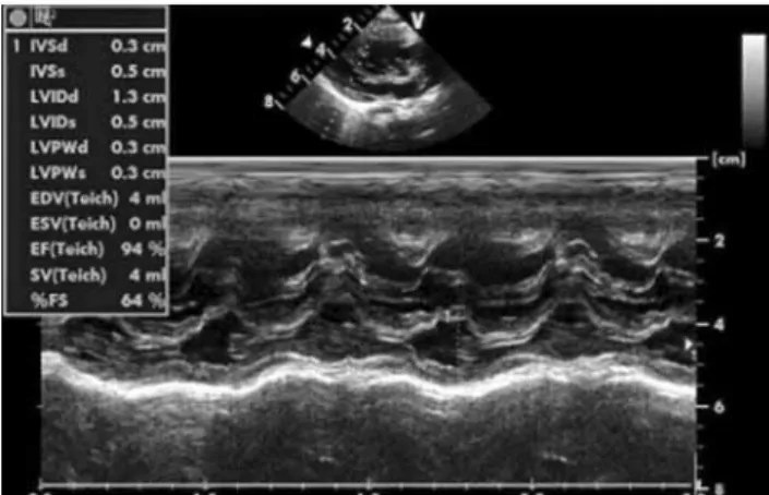 Figure 1. A two-dimensional echocardiographic image showing 