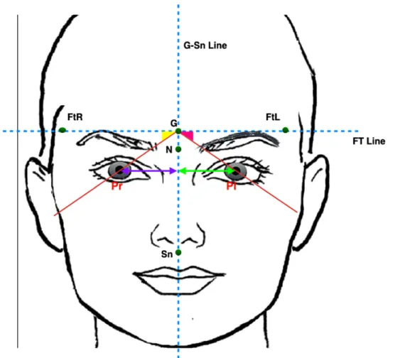 Fig. 1 Landmarks, lines and angles used in the study. Soft tissue landmarks: FtR frontotemporale right, FtL frontotemporale left, G glabella, N nasion soft, Pr right pupil, Pl left pupil, Sn subnasale