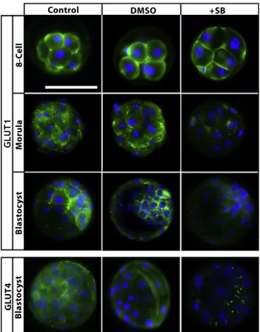 Fig. 3. Effect of p38 MAPK inhibition on GLUT1 and GLUT4 protein expression. Representative images for GLUT1 and GLUT4 in the absence and presence of SB203580