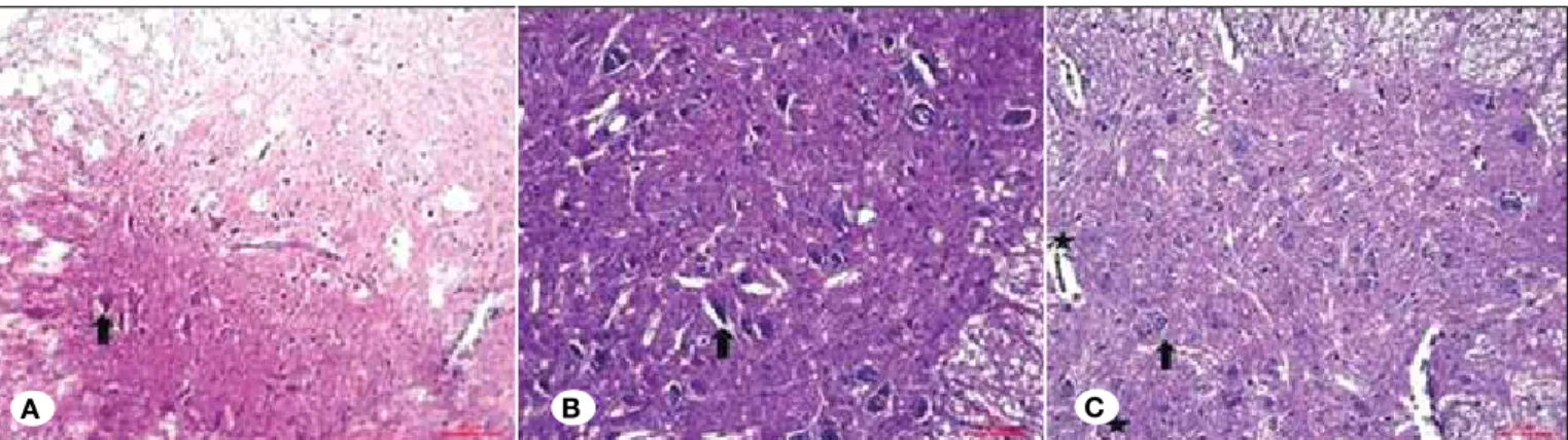 Figure 1: Hematoxylin and eosin staining; A) Group C; B) Group T; C) Group O. (Black arrows indicate neurons, stars indicate blood  vessels).