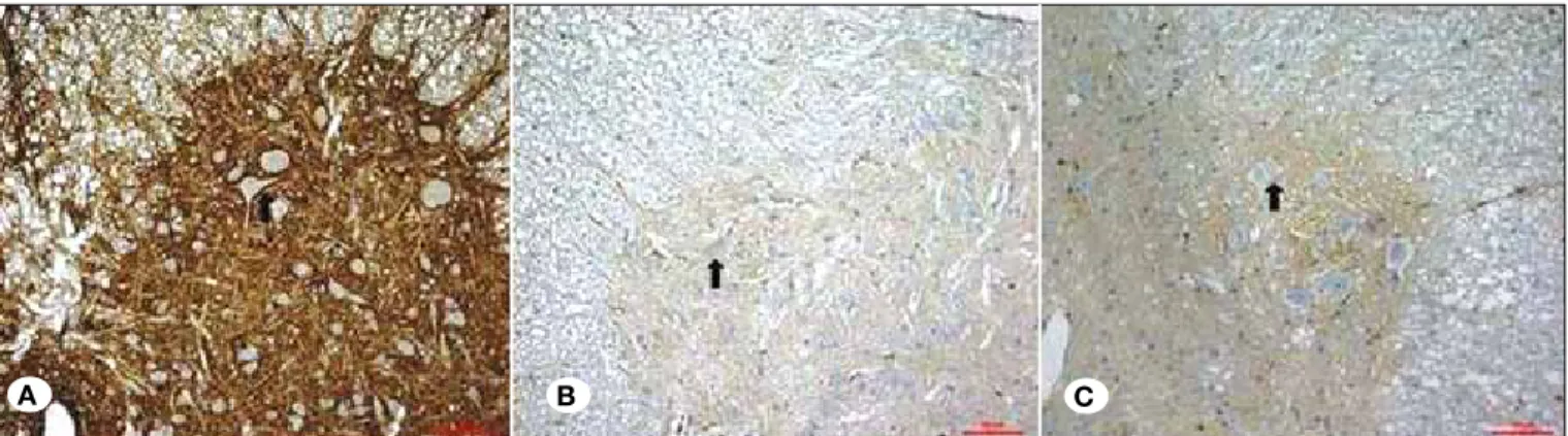 Figure 3: Immunohistochemical staining for β-catenin. A) Group C; B) Group T; C) Group O