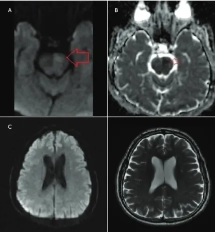 FIGURE 1. Diffusion-Weighted MRI Scan a