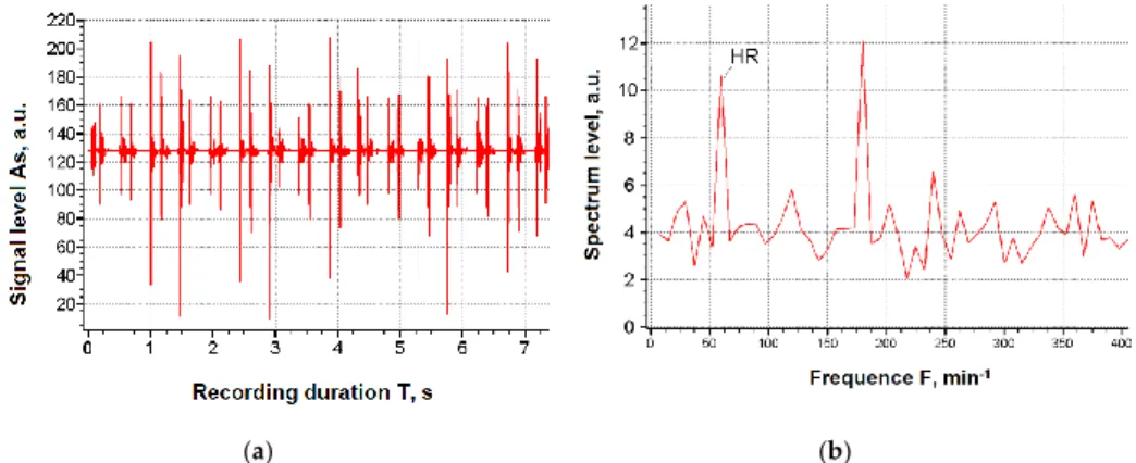 Figure 1 shows the typical cardiogram records and their spectra, used as source input data for forecasting the degree of the working capacity of a human operator