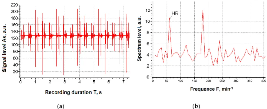 Figure 1 shows the typical cardiogram records and their spectra, used as source input data for forecasting the degree of the working capacity of a human operator