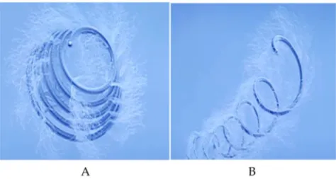 Figure 2. The type of coils used for EUS guıded coil application for varix obliteration