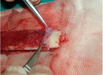 Fig. 7.  Periosteum stripped and folded at the end of the fibula and  view of the cambium layer