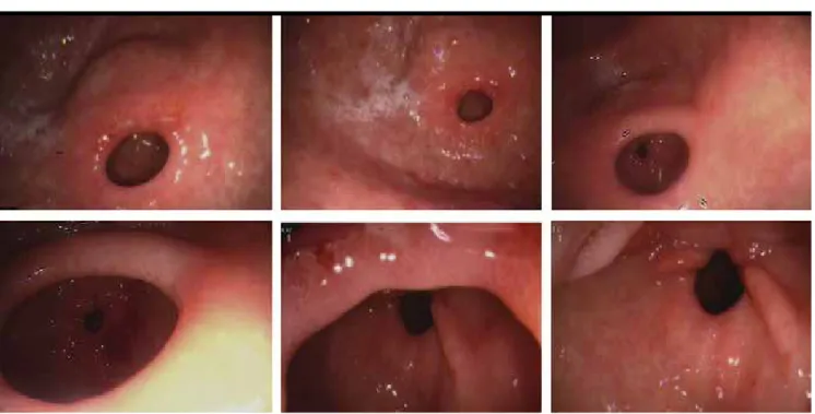 Figure 1. The endoscopic images of the case