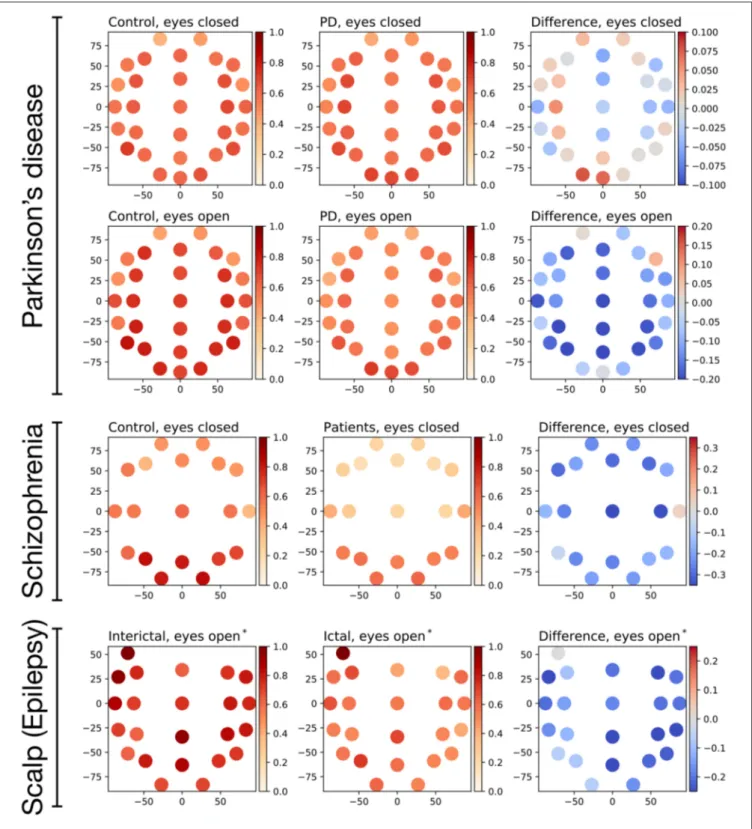 FIGURE 8 | Evolution of the average irreversibility by EEG channel in the three data sets corresponding to pathological conditions