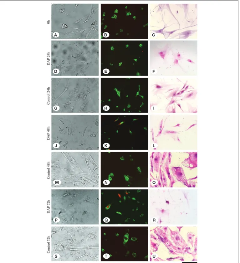 Figure 2: It is seen that the cells are viable, healthy, and adhere to the floor in the non-DAP-administered cell culture samples at 0  hour (A), 24 hours (G), 48 hours (M), and 72 hours (S) inverted light microscope analyses