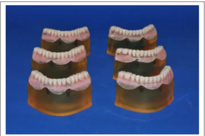 Figure 5.  Appearance of finished prostheses with mimic  mucosa before occlusal loading on photoelastic models