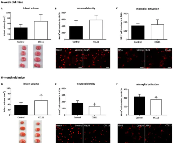 Figure 1. CCL11 aggravates acute ischemic brain injury in adult mice. C57BL6 male mice were subjected to cerebral ischemia for 45 min followed by reperfusion for 24 h
