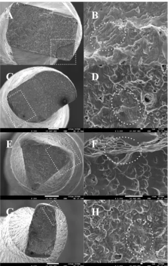 Figure  1.  Scanning  electron  microscopic  views  of  the  HEDM,  WOG,  RPC  Blue,  and  TFA  files  after  cyclic  fatigue  testing