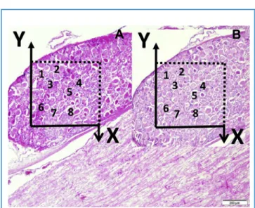 Figure 1. Histologic appearances of basilar artery in sulcus basilaris in pons (light microscopy [LM], hematoxylin and eosin, 4/A) and magnified form with arachnoid membrane (A), adventitia (star), smooth muscles in wall, inner elastic membrane (IEM) and e