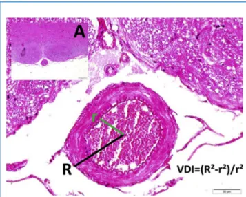 Figure 4. Histopathologic appearance of basilar artery in sulcus basilaris in pons (light microscopy [LM], hematoxylin and eosin, 4/A) and magnified form with vascular index calculation method in a sham-operated rabbit