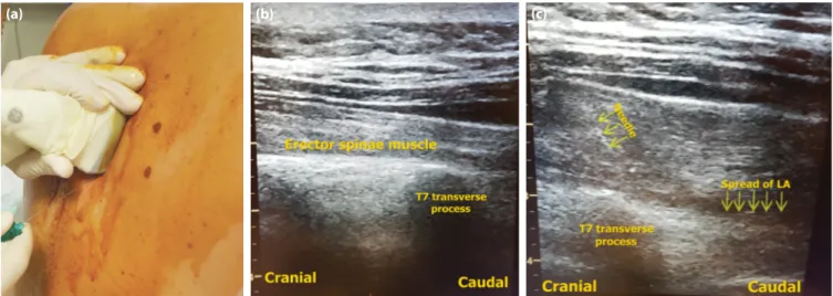 Figure 1. (a) Ultrasound and patient positioning under aseptic conditions for block preparation