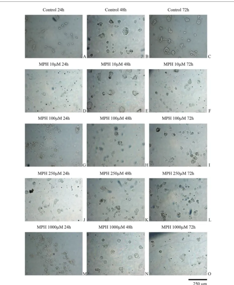 Figure 1: Evaluation of nucleus pulposus and annulus fibrosus cells by inverted light microscopy