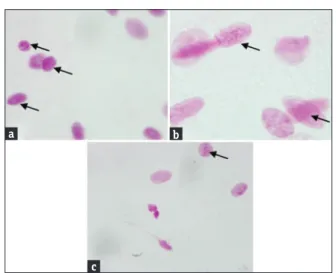 Figure 5:	 Inner	 (right)–outer	 (left)	 epithelia	 of	 tissues	 belong	 to	 participants	who	used	antibiotics	within	(a,	b)	1	month,	(c,	d)	4–6	months,	 and	 (e,	 f)	 7–12	 months	 previous	 to	 sampling.	 Black	 arrows	 indicate	 pyknotic	nuclei	(hematox