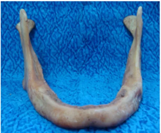 Figure 1. The mandible obtained from a formalin fixed  human cadaver. 