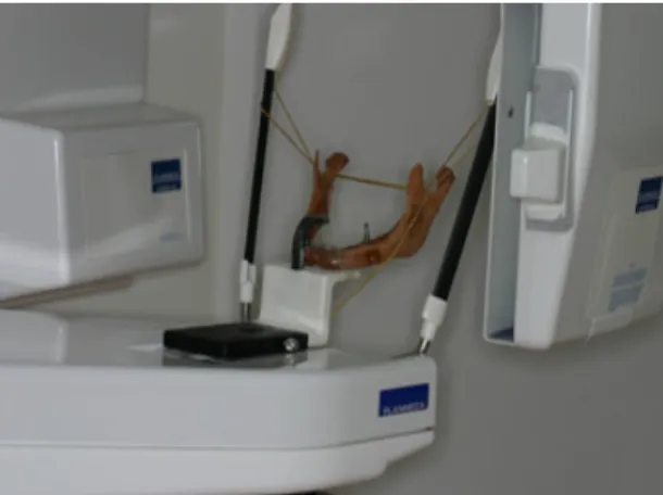 Figure 3. Conventional panoramic radiography of the mounted  mandible.