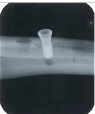 Figure 4. The radiographs taken with the parallel technique  give much better images which are suitable for making precise  measurements.