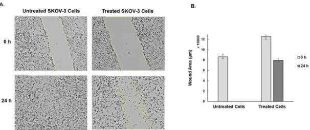 Figure 8. Wound healing assay of SKOV-3 cells with and without curcuminoids (30 µM) treatment