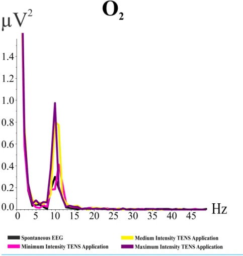 Figure 2 Grand averages of power spectrum analysis for O 2 electrode band for the “eyes open”