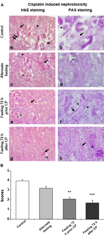 Figure 1. Seventy-two hours of fasting improves the histological parameters for CP induced  nephrotoxicity