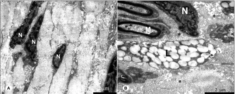 Figure 3:  Electron  microscopic  images  of  sections  from  cyclosporine-treated  (A),  and saline-treated (B)  nerves