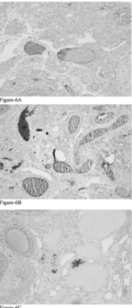Figure 6. — CD34 expression in the stroma of the ovaries in group 3 (A), group 2 (B), and group 1 (C).