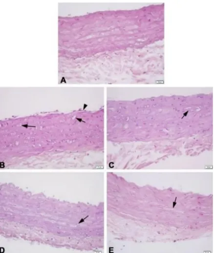Figure 11. Histological changes in aorta ring of aged animal. Endothelial cell (arrowhead), smooth muscle  cell (arrow)
