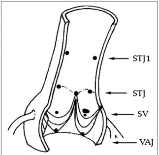 Figure 1:  Schematic presentation of four levels of aortic root  longitudinally where measurements were taken