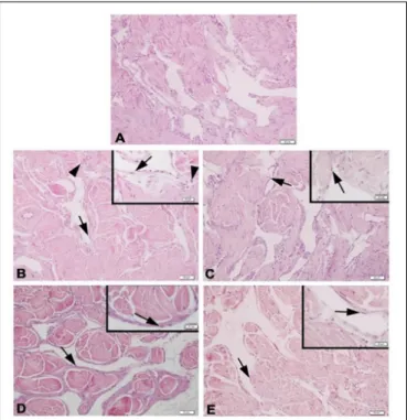 FIGURE 2 | Anti-apoptotic and apoptotic protein levels. P < 0.05 ∗ compared to Y-C; &amp; compared to O-S; n = 6 Y-C, young control; O-S, old sedentary;