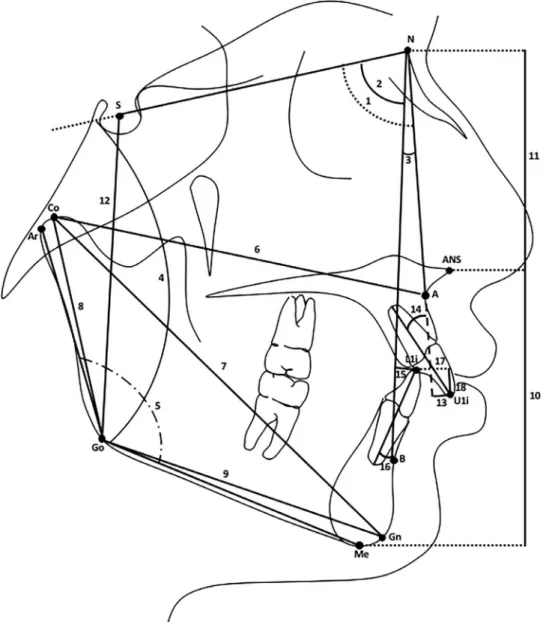 Figure 1. Cephalometric measurements. Skeletal angular measurements (8): (1) SNA; (2) SNB; (3) ANB; (4) GoGn/SN; and (5) Ar-Go-Me.