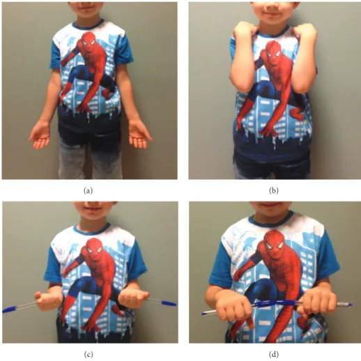 Figure 6: Clinical photos show full ROM of elbow and forearm rotation at the 8th week.