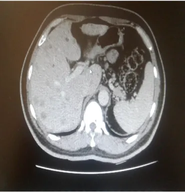 Figure 1: Abdominal CT image of the patient.