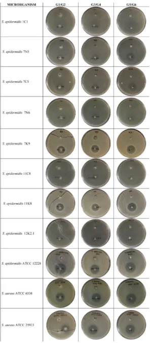 Figure 4. The images of zone diameters