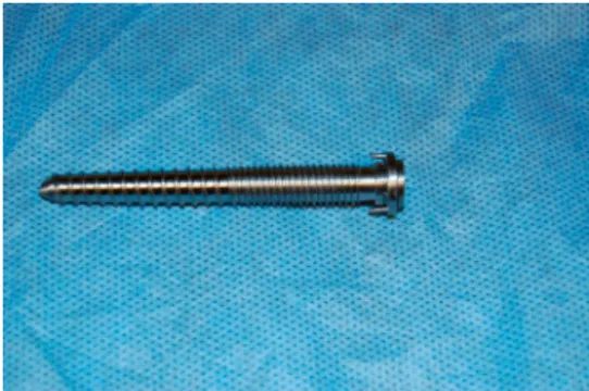 Figure 1 Picture of entry point demonstration. Figure 2 Picture of prototype of screw used in study.