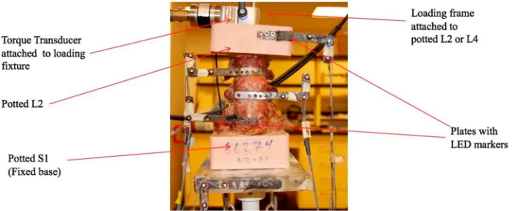 Figure 4 L2-Sacrum lumbar cadaveric specimen test setup.