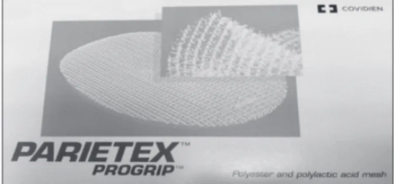 Figure 1 – Parietex ProGrip mesh  manufactured by Covidien.