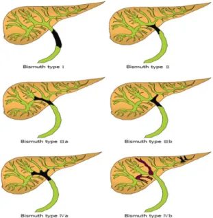 Diagram 1. Etiopathogenetic Mechanism in CC,  Etiologic Agents and Cholangiocyte Response to  Damage (From: Dalbir S