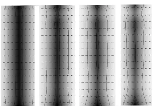 Figure 6.  With the passage of time, the osteoclastic resorption process grows abnormally deep and severs the trabecula.