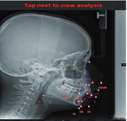 Figure 1. Cephalometric landmarks.