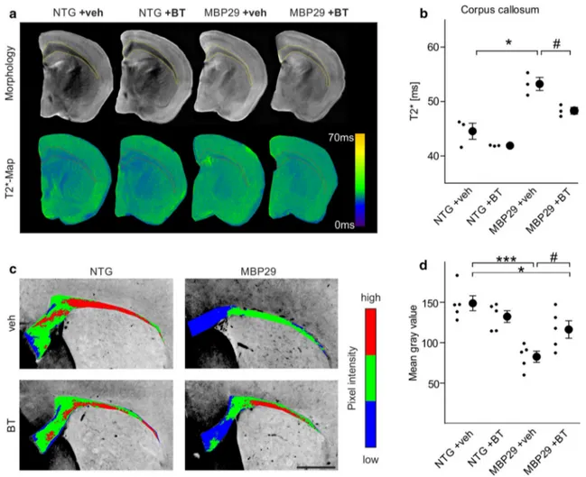 Fig. 7   Amelioration of the myelin deficit in mice with oligoden- oligoden-drocytic overexpression of α-synuclein (MBP29) upon benztropine  treatment