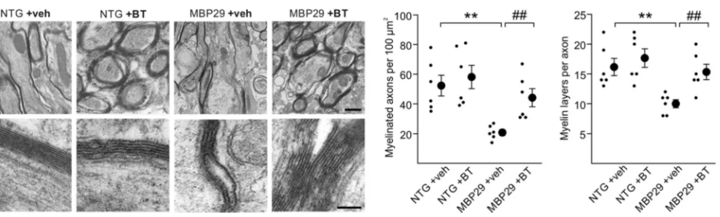 Fig. 8   Structural restoration of myelin by benztropine in mice over- over-expressing  α-synuclein in oligodendrocytes (MBP29)