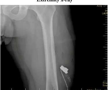 Fig. 1. Extremity x-ray.