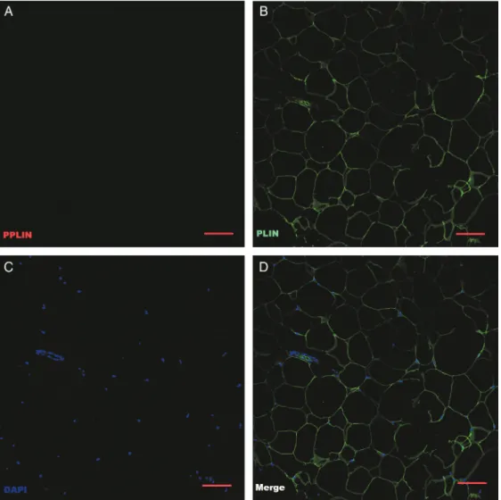 Figure 2. Confocal micrographs of immunostained adipocytes harvested before tumescence was induced (original magnification