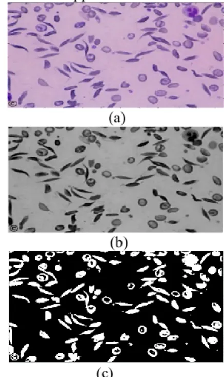 Figure 3.  Result of Thresholding Method. (a) RGB image (b)Grayscale  image(c) Binary image 