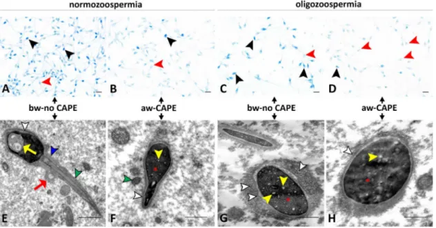 Fig. 1. Eﬀects of CAPE on sperm chromatin condensation and ultrastructural morphology.